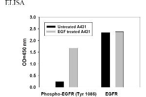 Image no. 4 for Epidermal Growth Factor Receptor (EGFR) ELISA Kit (ABIN625237) (EGFR ELISA Kit)
