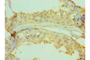 Immunohistochemistry of paraffin-embedded human testis tissue using ABIN7147353 at dilution of 1:100 (CETN2 Antikörper  (AA 1-172))