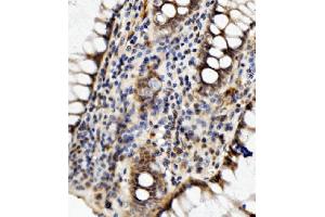IHC analysis of MED4 using anti-MED4 antibody (ABIN7600817). (MED4 Antikörper  (AA 24-254))