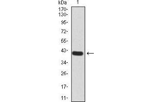 Western blot analysis using RALA mAb against human RALA (AA: 71-203) recombinant protein. (rala Antikörper  (AA 71-203))