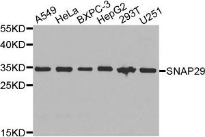 Western blot analysis of extracts of various cell lines, using SNAP29 antibody. (SNAP29 Antikörper)