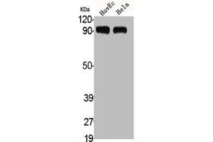 Western Blot analysis of HuvEc HELA cells using ADAMTS-1 Polyclonal Antibody (ADAMTS1 Antikörper  (Internal Region))