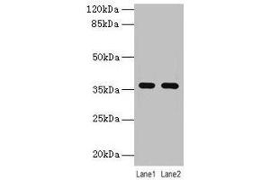 Western blot All lanes: LYPD3 antibody at 4 μg/mL Lane 1: MCF-7 whole cell lysate Lane 2: Mouse stomach tissue Secondary Goat polyclonal to rabbit IgG at 1/10000 dilution Predicted band size: 36 kDa Observed band size: 36 kDa (LYPD3 Antikörper  (AA 31-326))