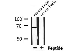 Western blot analysis of extracts from mouse brain, using BTRC Antibody. (BTRC Antikörper  (N-Term))