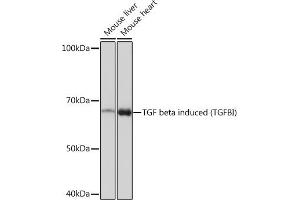 Western blot analysis of extracts of various cell lines, using TGF beta induced TGF beta induced (TGFBI) Rabbit mAb (ABIN7270915) at 1:1000 dilution. (TGFBI Antikörper)