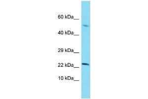 Western Blotting (WB) image for anti-Sterol Carrier Protein 2 (SCP2) (N-Term) antibody (ABIN2774151) (SCP2 Antikörper  (N-Term))