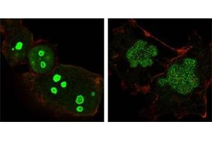Confocal immunofluorescence analysis of Hela (left) and NTERA-2 (right) cells using NPM antibody (green). (NPM1 Antikörper)