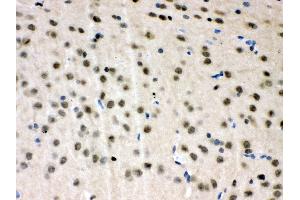 Immunohistochemistry (IHC) image for anti-Valosin Containing Protein (VCP) (AA 732-760), (C-Term) antibody (ABIN3043958)