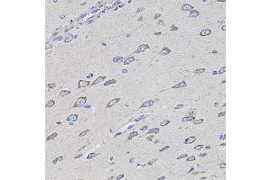 Immunohistochemistry of paraffin-embedded rat brain using TMC1 antibody (ABIN6134923, ABIN6149240, ABIN6149242 and ABIN6224704) at dilution of 1:100 (40x lens).