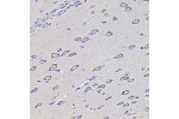 TMC1 Antikörper  (AA 600-700)