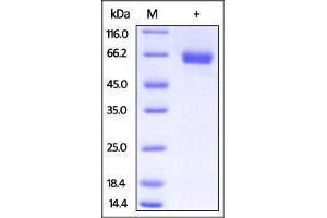 SDS-PAGE (SDS) image for Interleukin 4 Receptor (IL4R) (AA 26-233) protein (Fc Tag) (ABIN2870750)