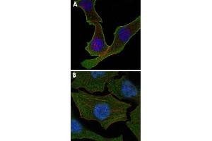 Confocal immunofluorescence analysis of SK-BR-3 (A) and A-549 (B) cells using CALR monoclonal antibody, clone 1G6A7  (green). (Calreticulin Antikörper)
