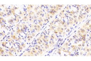 Detection of ITGb8 in Human Stomach Tissue using Polyclonal Antibody to Integrin Beta 8 (ITGb8) (ITGB8 Antikörper  (AA 471-629))