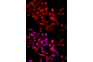 Immunofluorescence analysis of A549 cells using EIF4G1 antibody. (EIF4G1 Antikörper)