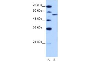 Western Blotting (WB) image for anti-Zinc Finger (CCCH Type), RNA-Binding Motif and serine/arginine Rich 2 (ZRSR2) antibody (ABIN2462182) (ZRSR2 Antikörper)