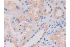 Immunohistochemistry (IHC) image for anti-Leucine Rich Repeat (In FLII) Interacting Protein 1 (LRRFIP1) (AA 615-735) antibody (ABIN1080220)
