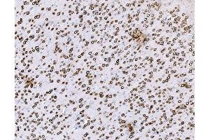 IHC analysis of BCKDHA using anti-BCKDHA antibody (ABIN7601223).