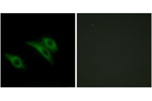 Immunofluorescence (IF) image for anti-CD9 (CD9) (AA 101-150) antibody (ABIN1534314)