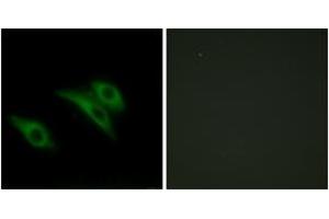 Immunofluorescence analysis of HeLa cells, using CD9 Antibody.