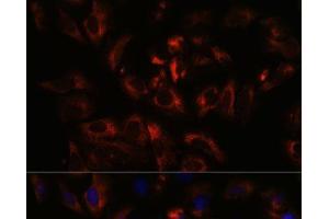 Immunofluorescence analysis of U-2 OS cells using RAB27A Polyclonal Antibody at dilution of 1:100. (RAB27A Antikörper)