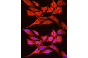 Immunofluorescence (IF) image for anti-Eukaryotic Translation Initiation Factor 2 alpha Kinase 4 (EIF2AK4) (AA 1-300) antibody (ABIN6140031)