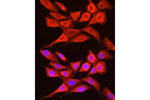 Immunofluorescence analysis of NIH/3T3 cells using GCN2 Rabbit pAb (ABIN6127829, ABIN6140031, ABIN6140033 and ABIN6216318) at dilution of 1:250 (40x lens). (GCN2 Antikörper  (AA 1-300))