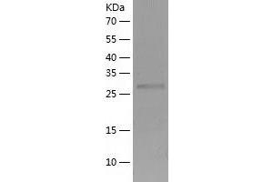 Western Blotting (WB) image for CTD (Carboxy-terminal Domain, RNA Polymerase II, Polypeptide A) Small Phosphatase 1 (CTDSP1) (AA 1-260) protein (His tag) (ABIN7288734) (CTDSP1 Protein (AA 1-260) (His tag))