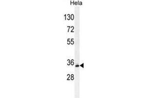 BCKDHB Antibody (N-term) western blot analysis in Hela cell line lysates (35µg/lane). (BCKDHB Antikörper  (N-Term))