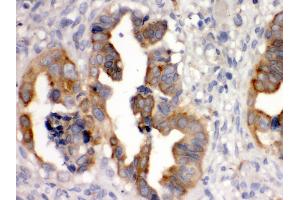Immunohistochemistry (Paraffin-embedded Sections) (IHC (p)) image for anti-Sulfotransferase Family, Cytosolic, 2B, Member 1 (SULT2B1) (AA 190-218), (Middle Region) antibody (ABIN3043414) (SULT2B1 Antikörper  (Middle Region))