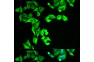 Immunofluorescence analysis of HeLa cells using STRN3 Polyclonal Antibody (STRN3 Antikörper)