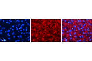 Immunohistochemistry (IHC) image for anti-Aldolase B, Fructose-Bisphosphate (ALDOB) (N-Term) antibody (ABIN5515769)