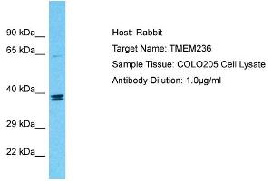 Host: Rabbit Target Name: TMEM236 Sample Tissue: Human COLO205 Whole Cell Antibody Dilution: 1ug/ml
