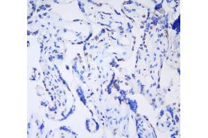 IHC analysis of HP1 gamma using anti-HP1 gamma antibody (ABIN5693033). (CBX3 Antikörper  (AA 2-183))