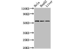 Western Blot Positive WB detected in: Hela whole cell lysate, HepG2 whole cell lysate, Mouse liver tissue All lanes: TOM1 antibody at 2. (TOM1 Antikörper  (AA 306-487))