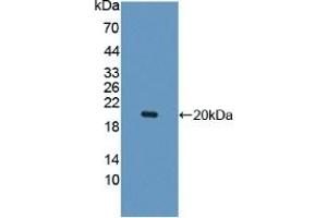 Detection of Recombinant IL10Rb, Human using Polyclonal Antibody to Interleukin 10 Receptor Beta (IL10Rb) (IL10RB Antikörper  (AA 87-243))
