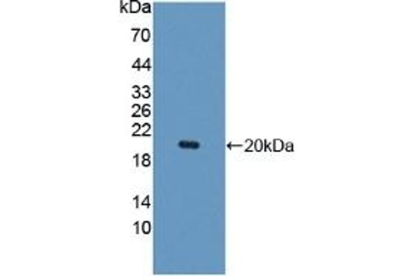 IL10RB Antikörper  (AA 87-243)