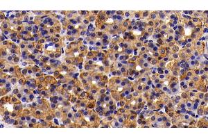 Detection of CK18 in Rat Stomach Tissue using Polyclonal Antibody to Cytokeratin 18 (CK18) (Cytokeratin 18 Antikörper  (AA 72-380))