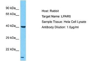 Host: Rabbit Target Name: LPAR6 Sample Type: Hela Whole Cell lysates Antibody Dilution: 1. (LPAR6 Antikörper  (N-Term))
