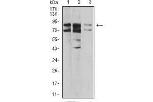 Western Blotting (WB) image for anti-Interleukin 1 Receptor Accessory Protein-Like 1 (IL1RAPL1) (AA 541-694) antibody (ABIN5542644)