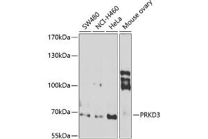 Western blot analysis of extracts of various cell lines, using PRKD3 antibody (ABIN6128465, ABIN6146216, ABIN6146217 and ABIN6222885) at 1:1000 dilution. (PRKD3 Antikörper  (AA 1-100))
