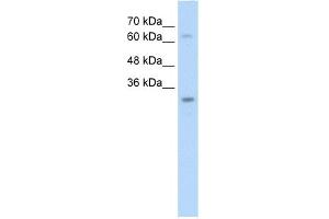 WB Suggested Anti-NSMCE1 Antibody Titration:  2. (NSMCE1 Antikörper  (N-Term))
