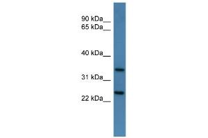 WB Suggested Anti-Clns1a Antibody Titration: 0. (CLNS1A Antikörper  (C-Term))