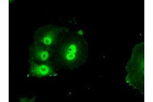Anti-BIRC7 mouse monoclonal antibody (ABIN2452813) immunofluorescent staining of COS7 cells transiently transfected by pCMV6-ENTRY BIRC7 (RC204906). (BIRC7 Antikörper)
