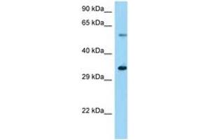 Image no. 1 for anti-Ubiquitin Specific Peptidase 27, X-Linked (USP27X) (AA 91-140) antibody (ABIN6748295) (USP27X Antikörper  (AA 91-140))