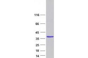 Western Blotting (WB) image for Golgi phosphoprotein 3 (Coat-Protein) (GOLPH3) protein (Myc-DYKDDDDK Tag) (ABIN2722138)