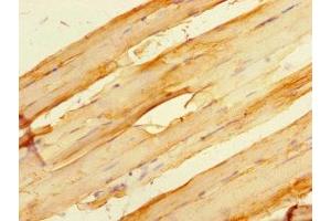 Immunohistochemistry of paraffin-embedded human skeletal muscle tissue using ABIN7154917 at dilution of 1:100 (HSPB7 Antikörper  (AA 1-170))