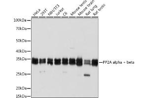 Western blot analysis of extracts of various cell lines, using PP2A alpha + beta Rabbit mAb (ABIN7269686) at 1:1000 dilution. (PPP2CB Antikörper)
