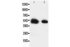 Anti-Glucose Transporter 8 antibody, Western blotting Lane 1: Rat Testis Tissue Lysate Lane 2: Human Placenta Tissue Lysate (SLC2A8 Antikörper  (C-Term))