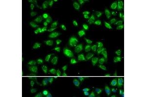 Immunofluorescence analysis of U2OS cells using MBTPS1 Polyclonal Antibody (MBTPS1 Antikörper)