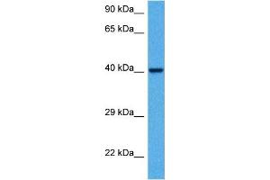 Host:  Mouse  Target Name:  KCNK3  Sample Tissue:  Mouse Kidney  Antibody Dilution:  1ug/ml (KCNK3 Antikörper  (C-Term))